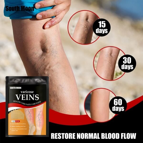 Varicose Veins Treatment Patch