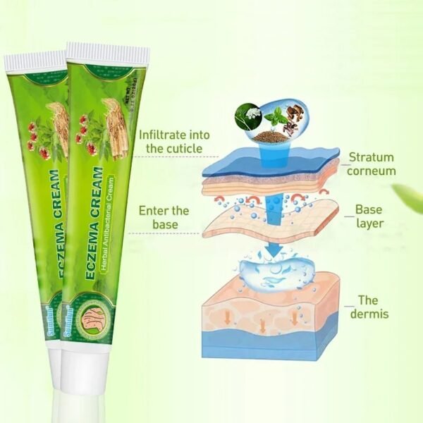 Sumifun Herbal Eczema Cream – Antipruritic & Antibacterial Skin Care 🌿🧴
