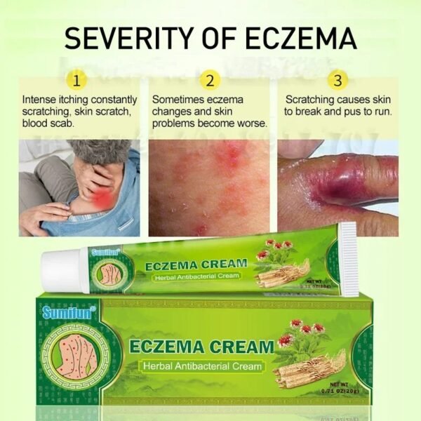 Sumifun Herbal Eczema Cream – Antipruritic & Antibacterial Skin Care 🌿🧴