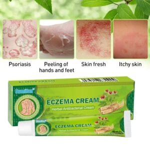 Sumifun Herbal Eczema Cream – Antipruritic & Antibacterial Skin Care 🌿🧴