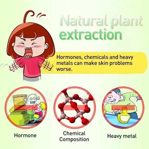 Sumifun Herbal Eczema Cream – Antipruritic & Antibacterial Skin Care 🌿🧴
