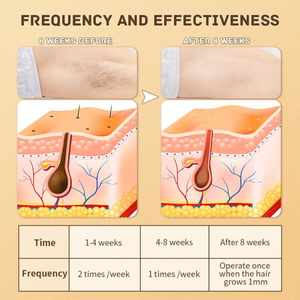 IPL Body Hair Remover Laser Epilator