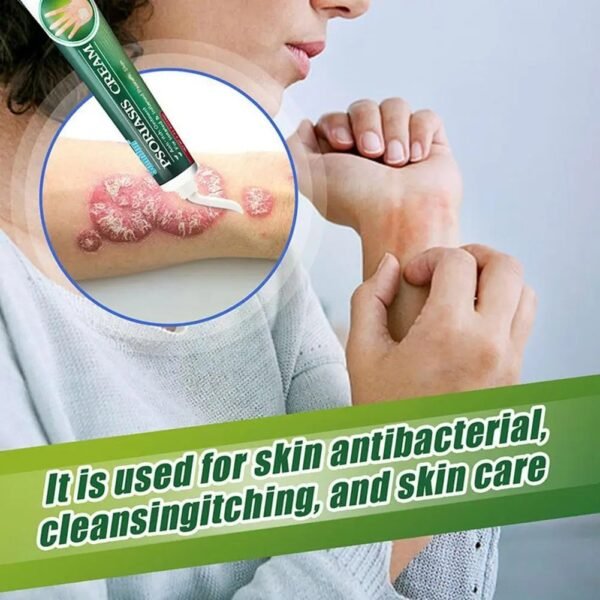 🌿 SuniFun Herbal Psoriasis & Eczema Relief Cream✨