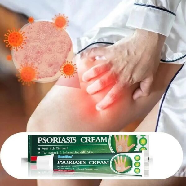 🌿 SuniFun Herbal Psoriasis & Eczema Relief Cream✨