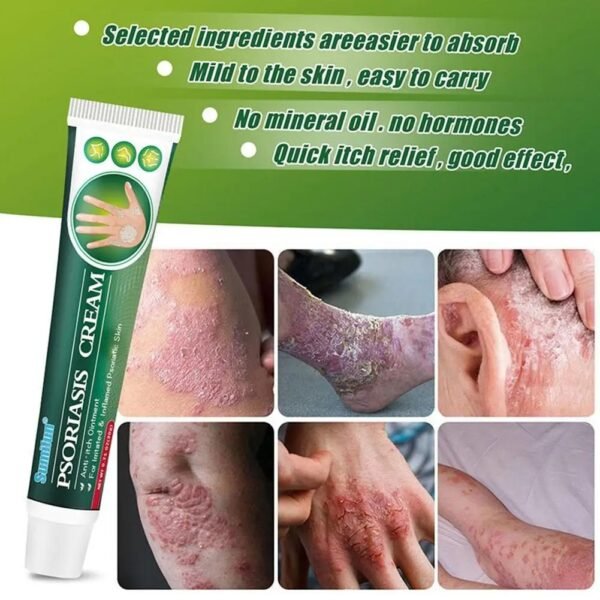 🌿 SuniFun Herbal Psoriasis & Eczema Relief Cream✨