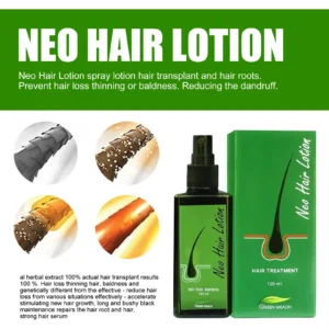 🌿 Neo Hair Lotion-Hair Regrowth 🌿